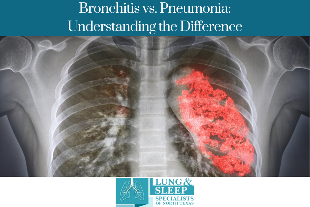 Bronchitis vs. Pneumonia: Understanding the Difference